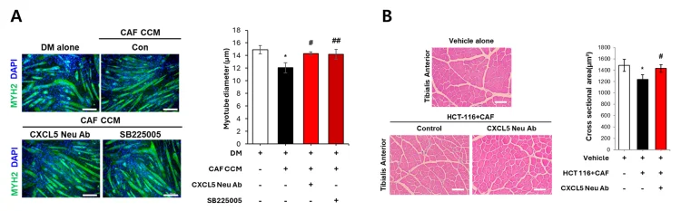 암환자 근육 소모 세계 첫 규명…GIST, 핵심 단백질 밝혀